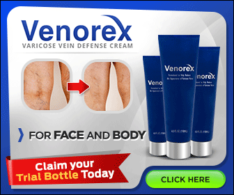 Venorex Varicose Veins Cream.