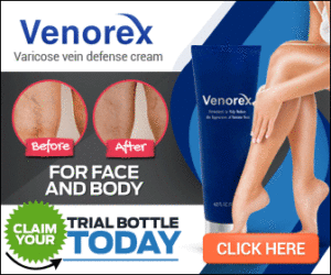 varicose vein cream
